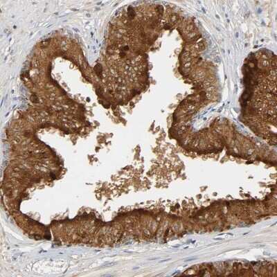 Immunohistochemistry-Paraffin: Prostatic Acid Phosphatase/ACPP Antibody [NBP1-90263]