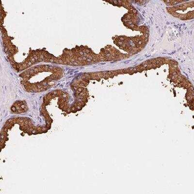 Immunohistochemistry-Paraffin: Prostatic Acid Phosphatase/ACPP Antibody [NBP2-39012]