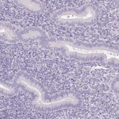 Immunohistochemistry-Paraffin: Prostatic Acid Phosphatase/ACPP Antibody [NBP2-39012]