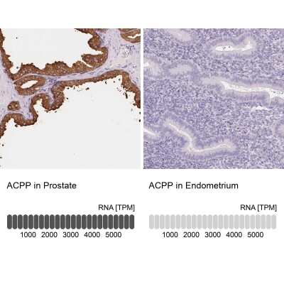 Immunohistochemistry-Paraffin: Prostatic Acid Phosphatase/ACPP Antibody [NBP2-39012]