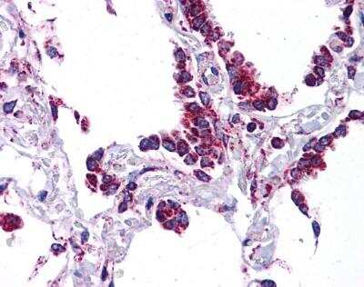 Immunohistochemistry-Paraffin: Prosurfactant Protein C Antibody [NBP1-60117]