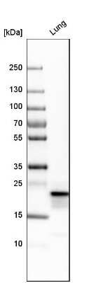 Western Blot: Prosurfactant Protein C Antibody [NBP1-87201]