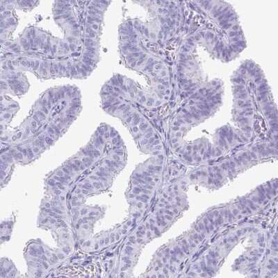 Immunohistochemistry-Paraffin: Protamine 2 Antibody [NBP2-31637]