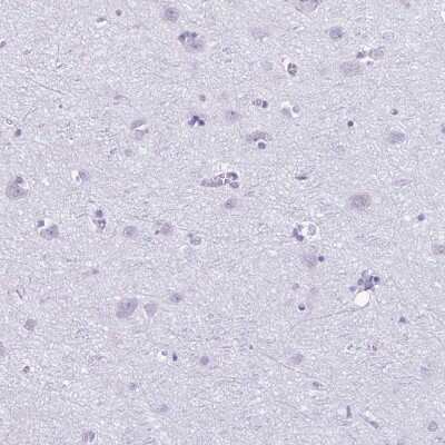 Immunohistochemistry-Paraffin: Protamine 2 Antibody [NBP2-31637]
