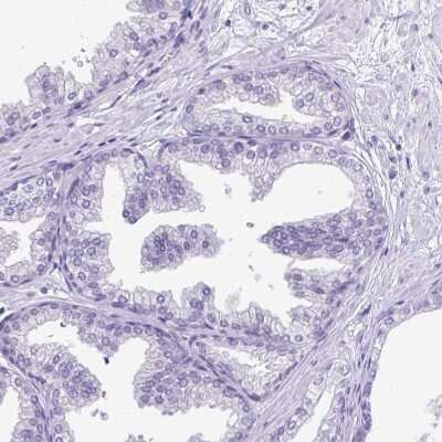 Immunohistochemistry-Paraffin: Protamine 2 Antibody [NBP2-31637]