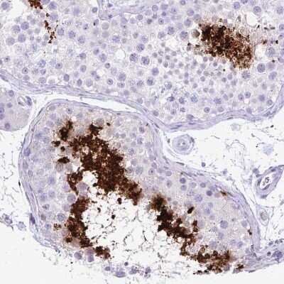 Immunohistochemistry-Paraffin: Protamine 2 Antibody [NBP2-31637]