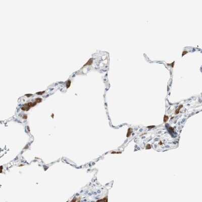 Immunohistochemistry-Paraffin: Protease Inhibitor 15 Antibody [NBP1-82445]