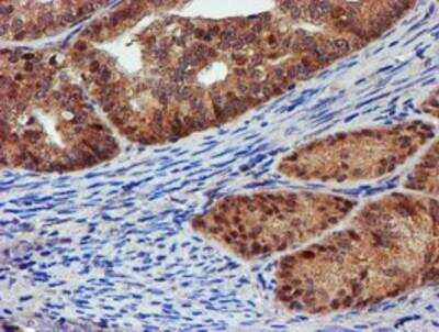 Immunohistochemistry-Paraffin: Proteasome 19S 10B Antibody (OTI1G6) [NBP2-00990]