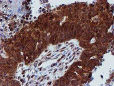 Immunohistochemistry-Paraffin: Proteasome 19S 10B Antibody (OTI1G6) [NBP2-00990]