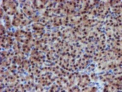 Immunohistochemistry-Paraffin: Proteasome 19S 10B Antibody (OTI1G6) [NBP2-00990]
