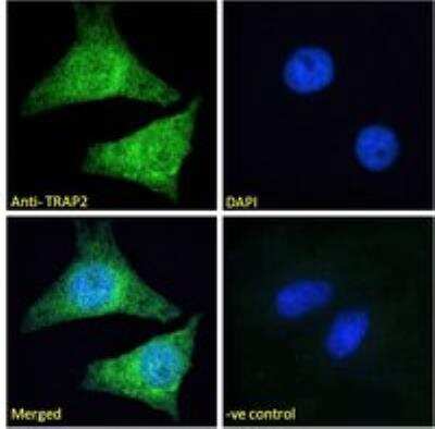 Immunocytochemistry/ Immunofluorescence: Proteasome 19S 10B Antibody [NB100-1483]