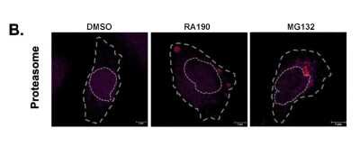 Immunocytochemistry/ Immunofluorescence: Proteasome 19S 10B Antibody [NB100-1483]