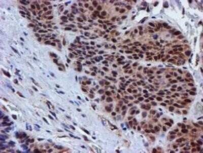 Immunohistochemistry: Proteasome 19S 10B Antibody (OTI1G6) - Azide and BSA Free [NBP2-73627]
