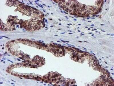 Immunohistochemistry: Proteasome 19S 10B Antibody (OTI1G6) - Azide and BSA Free [NBP2-73627]