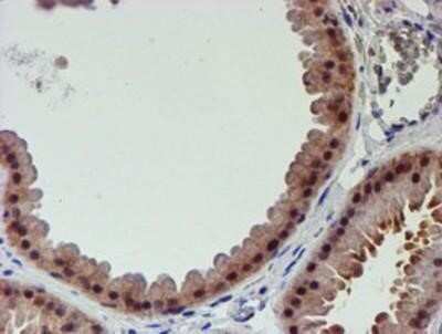 Immunohistochemistry: Proteasome 19S 10B Antibody (OTI1G6) - Azide and BSA Free [NBP2-73627]