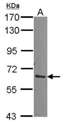 Western Blot: Proteasome 19S S3 Antibody [NBP1-31530]