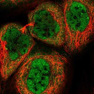 Immunocytochemistry/ Immunofluorescence: S5a/Angiocidin Antibody [NBP2-37888]