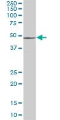 Western Blot: S5a/Angiocidin Antibody [H00005710-B01P]