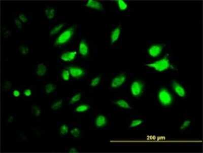 Immunocytochemistry/ Immunofluorescence: Proteasome 19S S7 Antibody (4C10-2C8) [H00005701-M01]