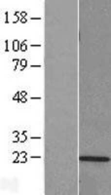 Western Blot: LMP2/PSMB9 Overexpression Lysate [NBL1-14885]