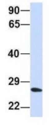 Western Blot: PSMA2 Antibody [NBP1-54633]