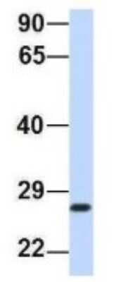 Western Blot: PSMA2 Antibody [NBP1-54633]