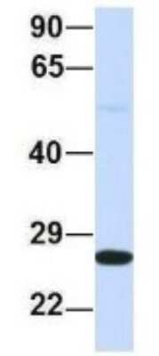 Western Blot: PSMA2 Antibody [NBP1-54633]