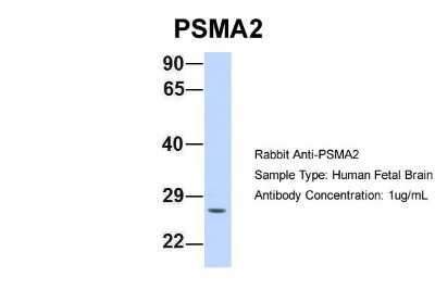 Western Blot: PSMA2 Antibody [NBP1-54633]