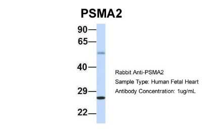 Western Blot: PSMA2 Antibody [NBP1-54633]
