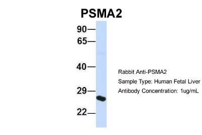 Western Blot: PSMA2 Antibody [NBP1-54633]
