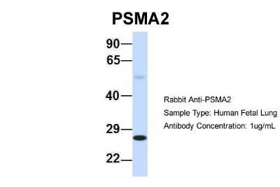 Western Blot: PSMA2 Antibody [NBP1-54633]