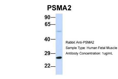 Western Blot: PSMA2 Antibody [NBP1-54633]