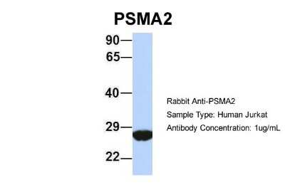 Western Blot: PSMA2 Antibody [NBP1-54633]