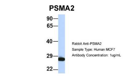 Western Blot: PSMA2 Antibody [NBP1-54633]