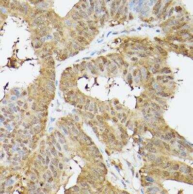 Immunohistochemistry-Paraffin: Proteasome 20S alpha 3 Antibody - Azide and BSA Free [NBP2-94032]