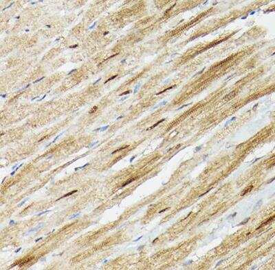 Immunohistochemistry-Paraffin: Proteasome 20S alpha 3 Antibody - Azide and BSA Free [NBP2-94032]