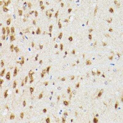 Immunohistochemistry-Paraffin: Proteasome 20S alpha 3 Antibody - Azide and BSA Free [NBP2-94032]