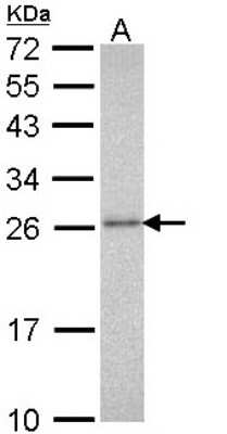 Western Blot: Proteasome 20S alpha 3 Antibody [NBP1-33537]