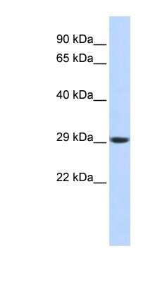 Western Blot: Proteasome 20S alpha 3 Antibody [NBP1-54374]