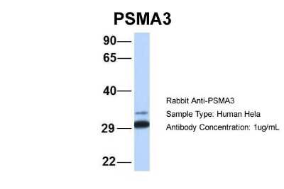 Western Blot: Proteasome 20S alpha 3 Antibody [NBP1-54374]
