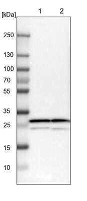 Western Blot: Proteasome 20S alpha 3 Antibody [NBP1-92293]