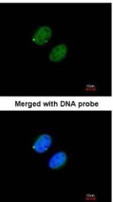 Immunocytochemistry/ Immunofluorescence: Proteasome 20S alpha 5 Antibody [NBP1-32387]