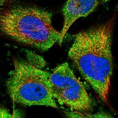 Immunocytochemistry/ Immunofluorescence: Proteasome 20S alpha 5 Antibody [NBP1-86838]
