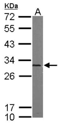 Western Blot: Proteasome 20S alpha 5 Antibody [NBP1-32387]