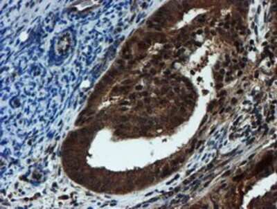 Immunohistochemistry-Paraffin: Proteasome 20S alpha 6 Antibody (OTI4C9) [NBP2-03836]