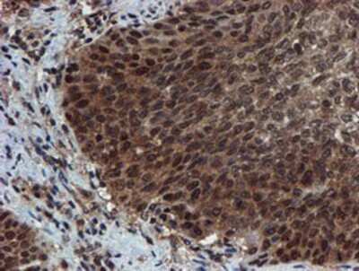 Immunohistochemistry-Paraffin: Proteasome 20S alpha 6 Antibody (OTI4C9) [NBP2-03836]