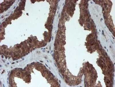 Immunohistochemistry-Paraffin: Proteasome 20S alpha 6 Antibody (OTI4C9) [NBP2-03836]
