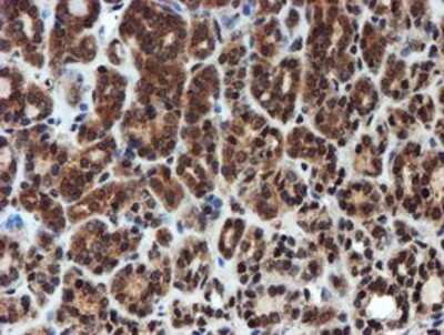 Immunohistochemistry-Paraffin: Proteasome 20S alpha 6 Antibody (OTI4C9) [NBP2-03836]