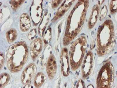 Immunohistochemistry-Paraffin: Proteasome 20S alpha 6 Antibody (OTI4C9) [NBP2-03836]