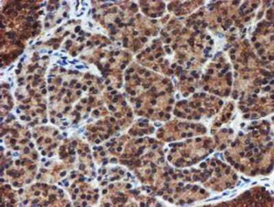 Immunohistochemistry-Paraffin: Proteasome 20S alpha 6 Antibody (OTI4C9) [NBP2-03836]